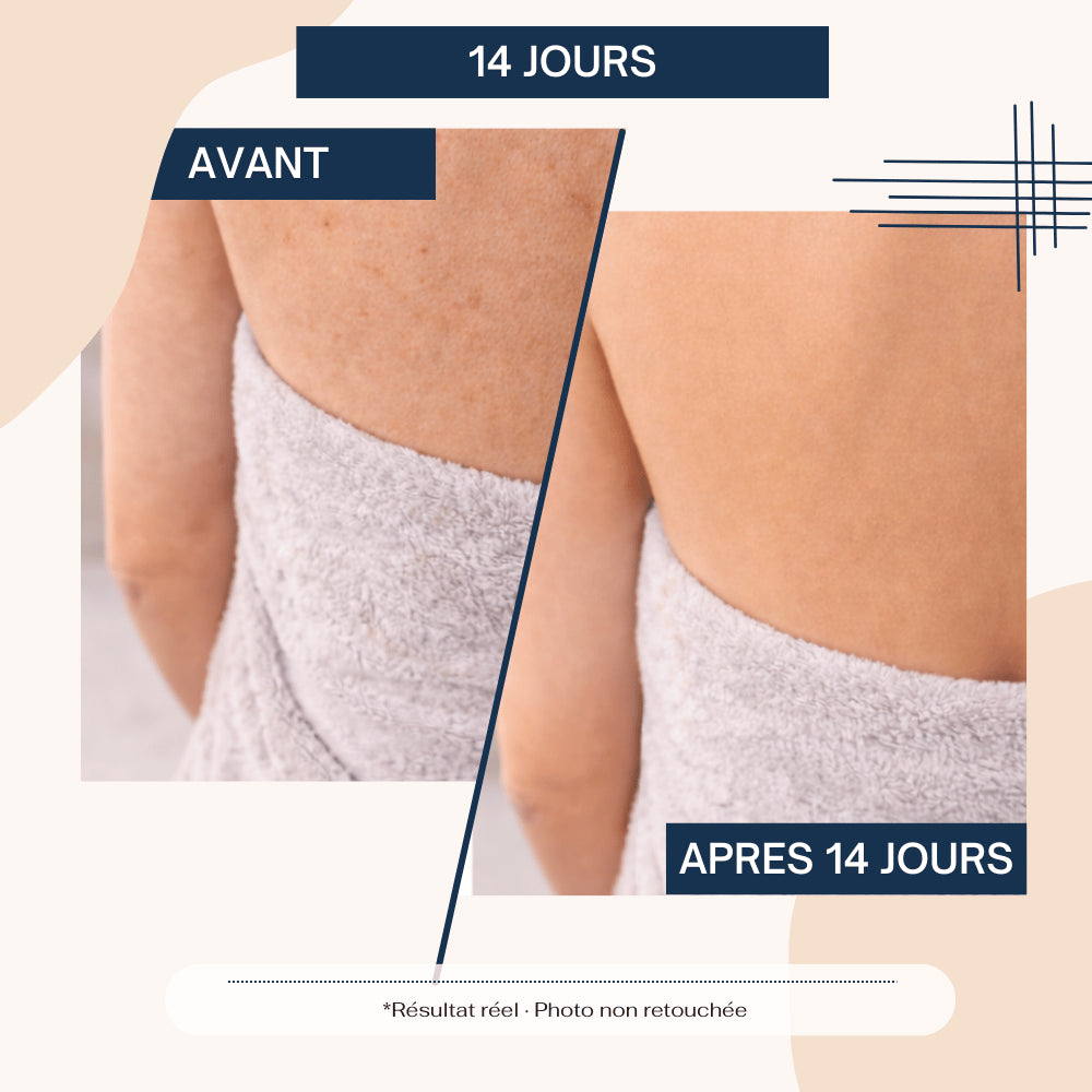 serviette exfoliante avant apès